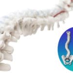 Scoliose, Cyphose, Lordose… les réponses en chiropractie