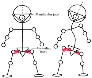 scoliose et chiropraxie - compensations musculaires