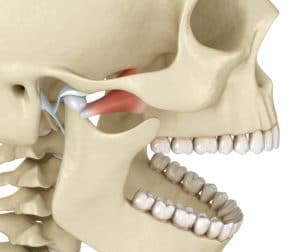 pterygoide muscle en chiro