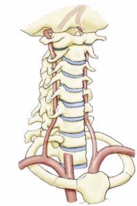 artère vertébrale en chiropraxie